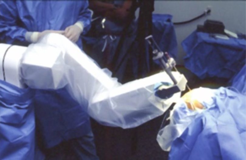 Robotics In Neurosurgery: Another Tool To Improve Outcomes — Lucia ...